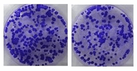 克隆形成检测克隆形成检测细胞