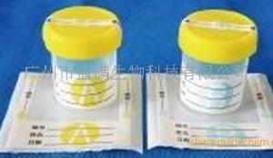 尿液包装AB瓶及标签