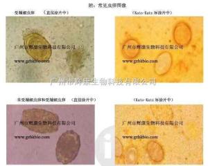 改良加藤法寄生虫卵检测制片盒 产品图片