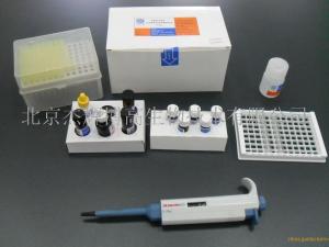 兔抗单核细胞抗体(AMA)ELISA试剂盒说明书
