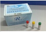 小鼠Ⅰ型前胶原C末端肽(CⅠCP)检测试剂盒 产品图片
