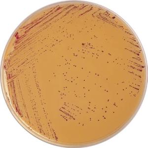 金黄色葡萄球菌显色培养基