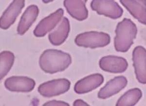 HEC-1-A    人子宫内膜腺癌细胞