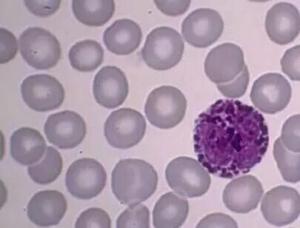 RM-1　　小鼠qian列腺癌细胞