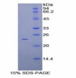 原钙黏素β2(PCDHβ2)重组蛋白 产品图片