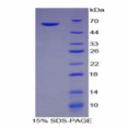 整合素α5(ITGα5)重组蛋白 产品图片