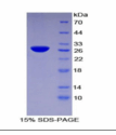 组织因子通道抑制因子2(TFPI2)重组蛋白 产品图片