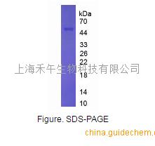 环腺苷二磷酸核糖水解酶(cadprh)重组蛋白